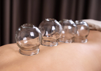 Cupping Therapy